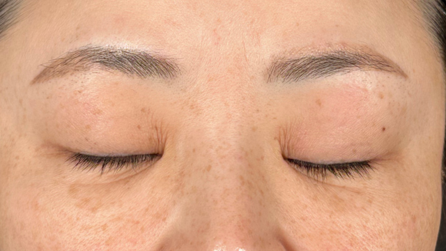 Preoperative Condition Part 1