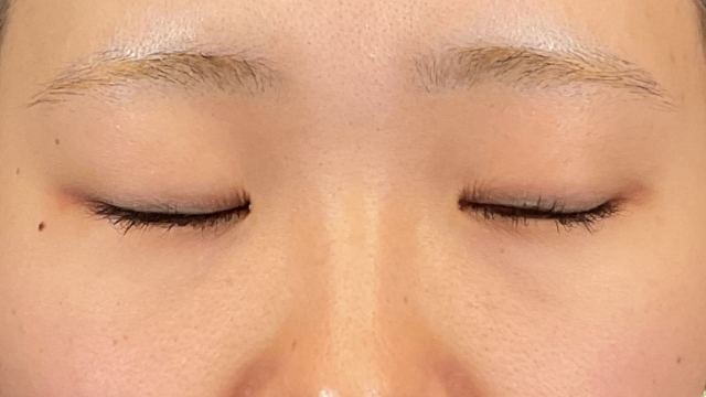 Preoperative Condition Part 1