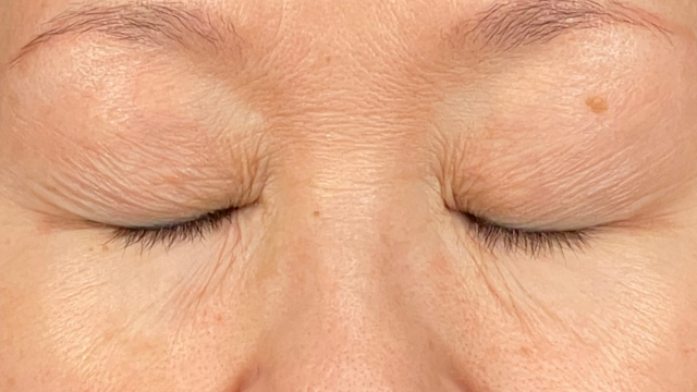 Preoperative Condition Part 1