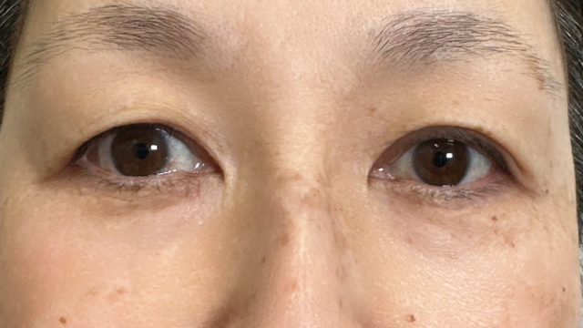 Preoperative Condition Part 1