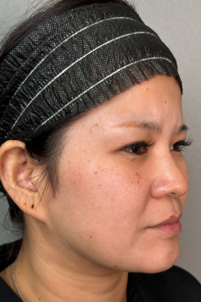 Preoperative Condition Part 1