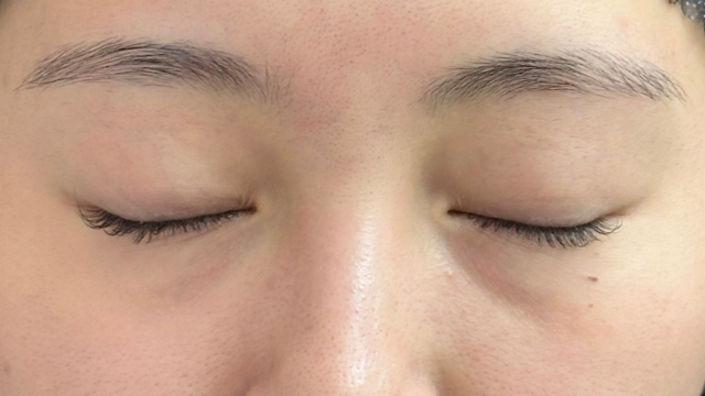 Preoperative Condition Part 1