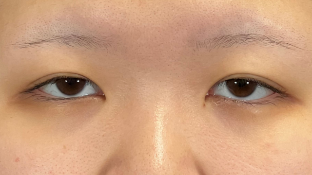 Preoperative Condition Part 1