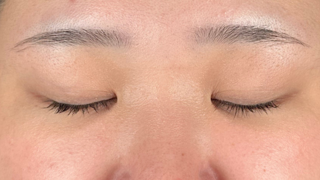 Preoperative Condition Part 1