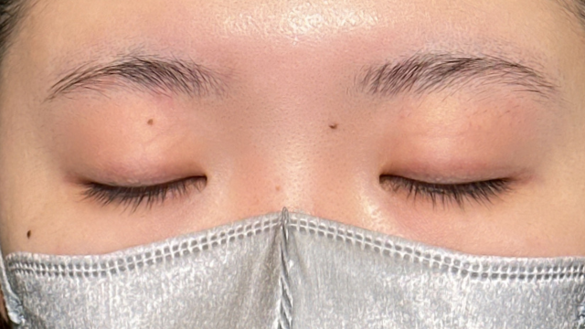 Preoperative Condition Part 1