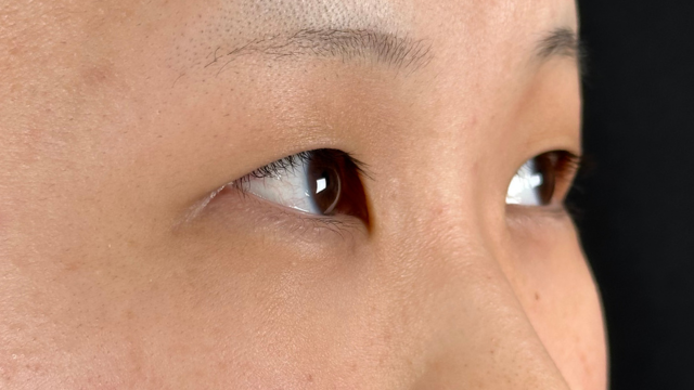 Preoperative Condition Part 1