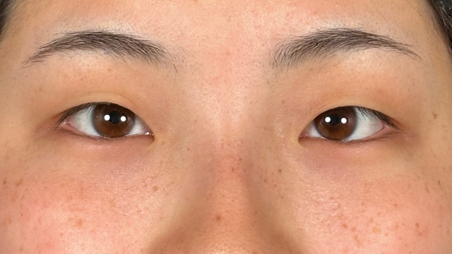 Preoperative Condition Part 1