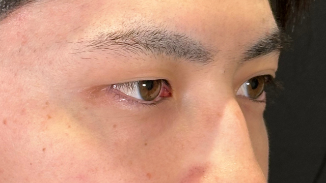 Preoperative Condition Part 1