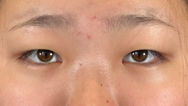 Preoperative Condition Part 1