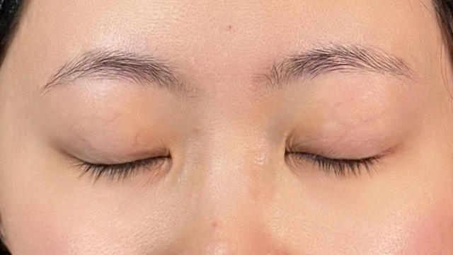 Preoperative Condition Part 1