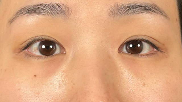 Preoperative Condition Part 1