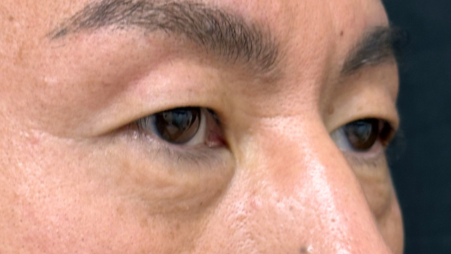 Preoperative Condition Part 1