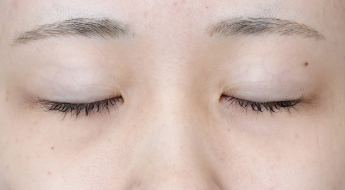 Preoperative Condition Part 1