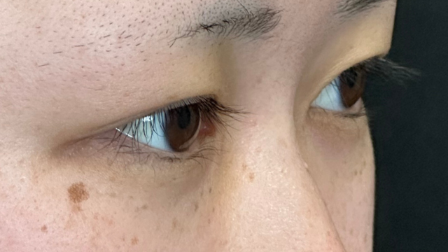 Preoperative Condition Part 1