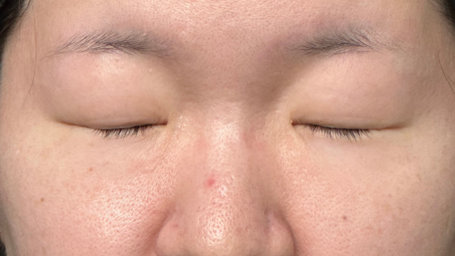 Preoperative Condition Part 1