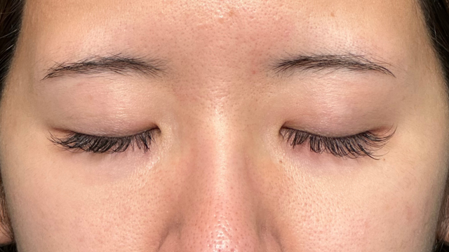 Preoperative Condition Part 1