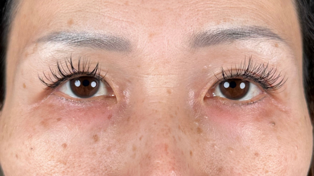 Preoperative Condition Part 1