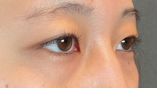 Preoperative Condition Part 1