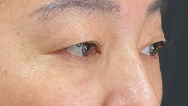 Preoperative Condition Part 1