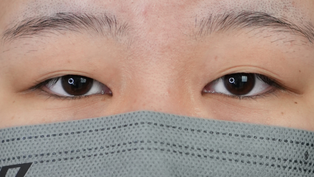 Preoperative Condition Part 1