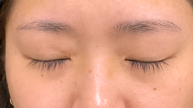 Preoperative Condition Part 1