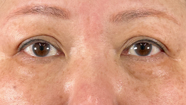 Preoperative Condition Part 1