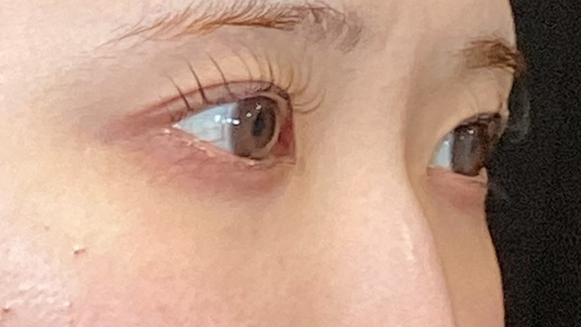 Preoperative Condition Part 1