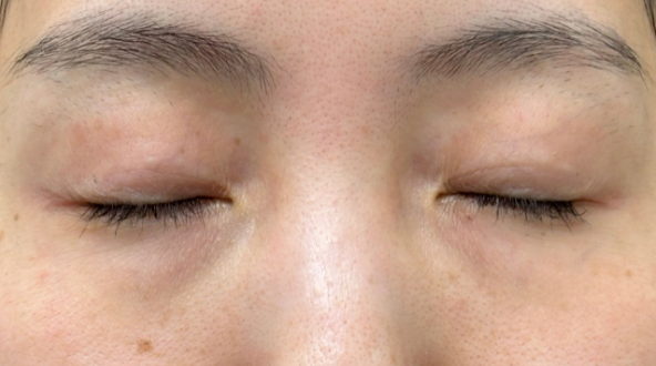 Preoperative Condition Part 1