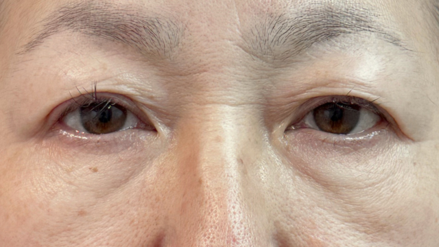 Preoperative Condition Part 1