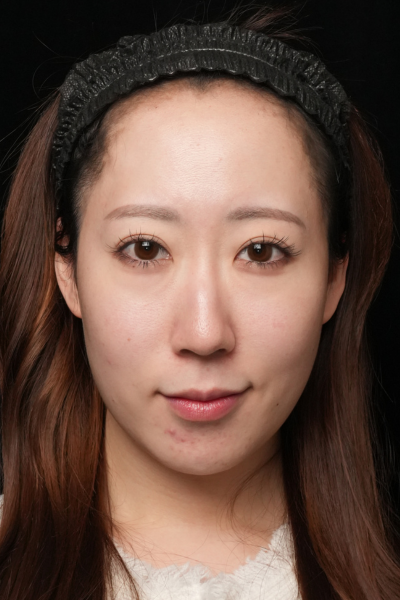 Preoperative Condition Part 1