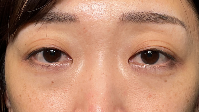 Preoperative Condition Part 1