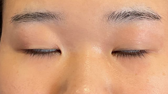 Preoperative Condition Part 1