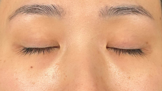 Preoperative Condition Part 1