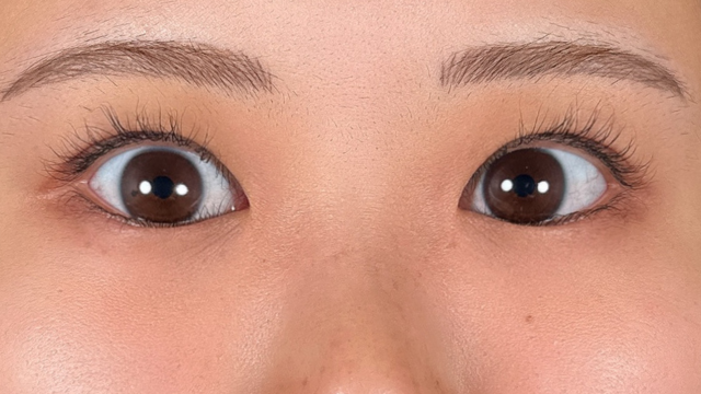 Preoperative Condition Part 1