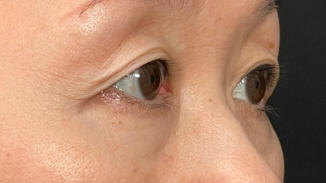 Preoperative Condition Part 1