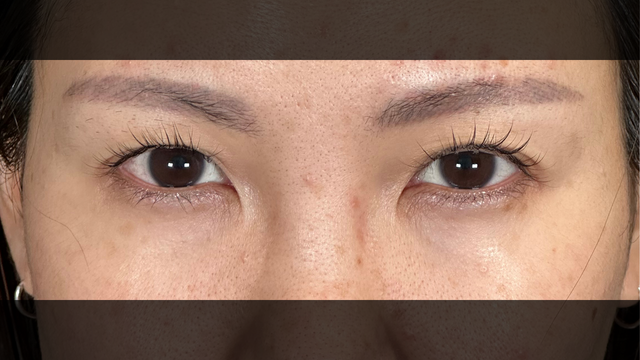 Preoperative Condition Part 1