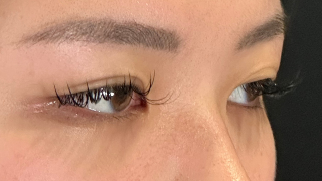 Preoperative Condition Part 1