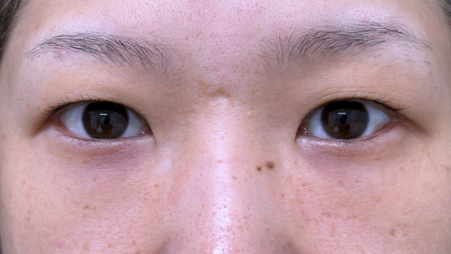 Preoperative Condition Part 1