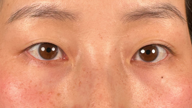 Preoperative Condition Part 1