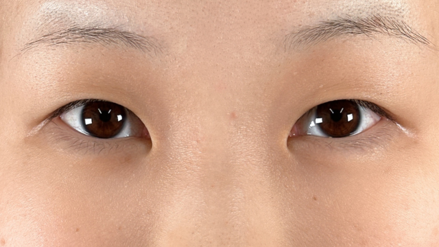 Preoperative Condition Part 1