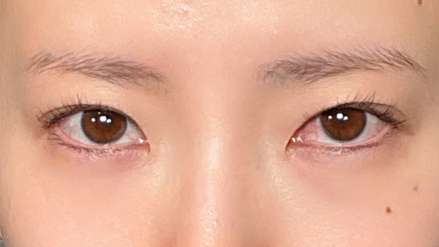 Preoperative Condition Part 1