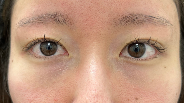 Preoperative Condition Part 1