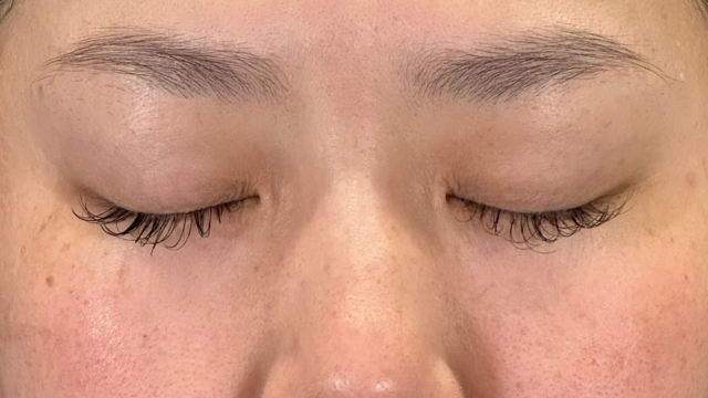 Preoperative Condition Part 1