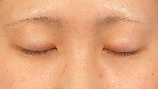 Preoperative Condition Part 1