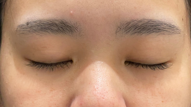 Preoperative Condition Part 1