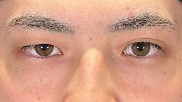 Preoperative Condition Part 1