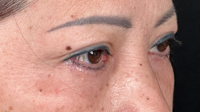 Preoperative Condition Part 1