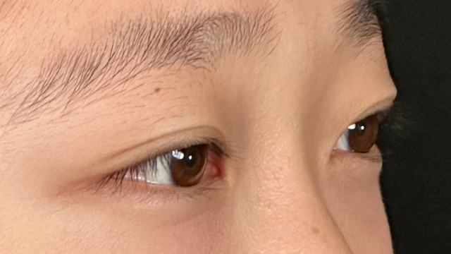 Preoperative Condition Part 1