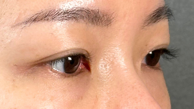 Preoperative Condition Part 1