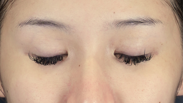 Preoperative Condition Part 1